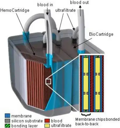 Cuando sea miniaturizado, el riñón artificial podría implantarse en el paciente