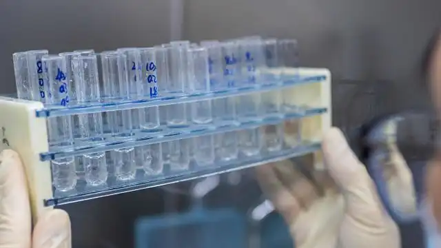 Coronavirus Vacuna UBA